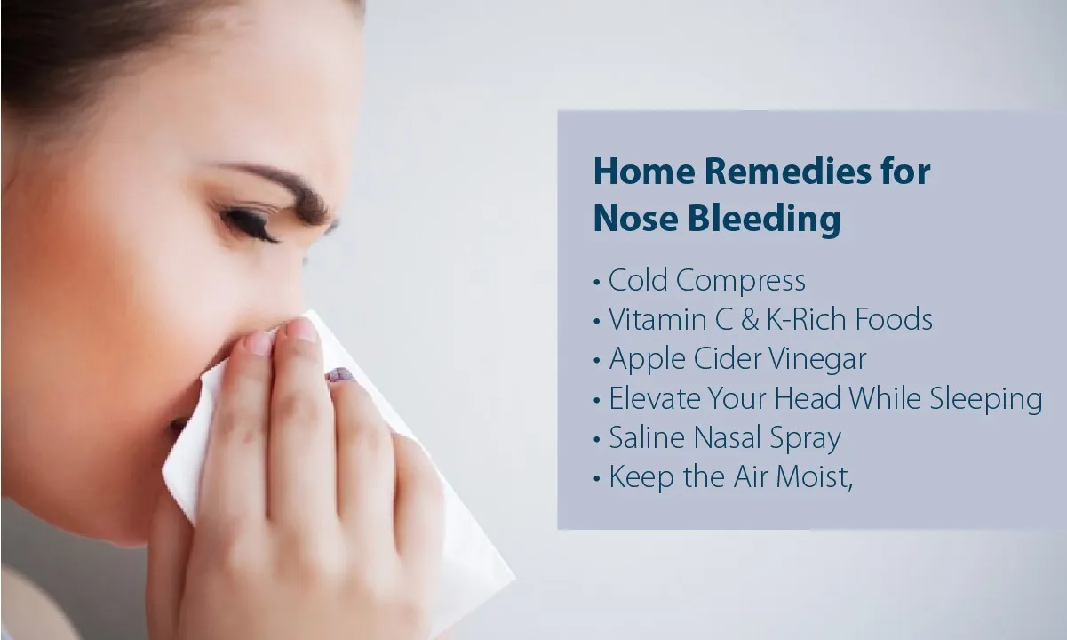 Top 10 Home Remedies for Nose Bleeding